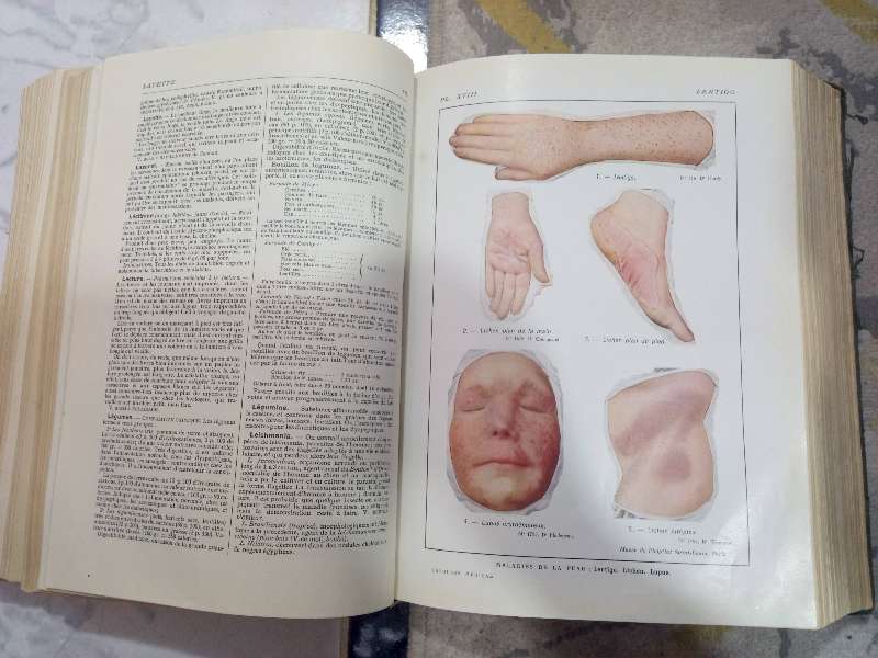 Larousse médical illustré de 1924 paris - Miniature 8